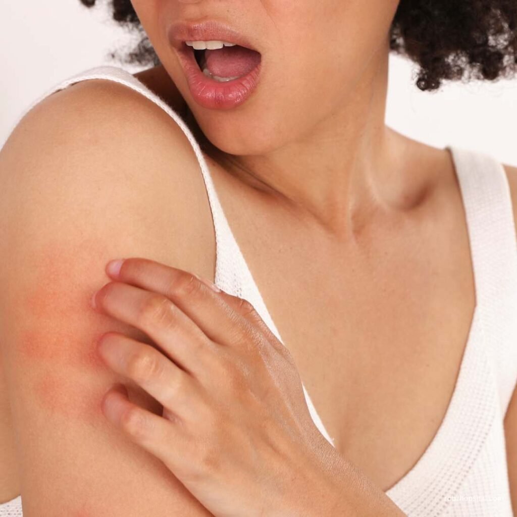 skin allergy