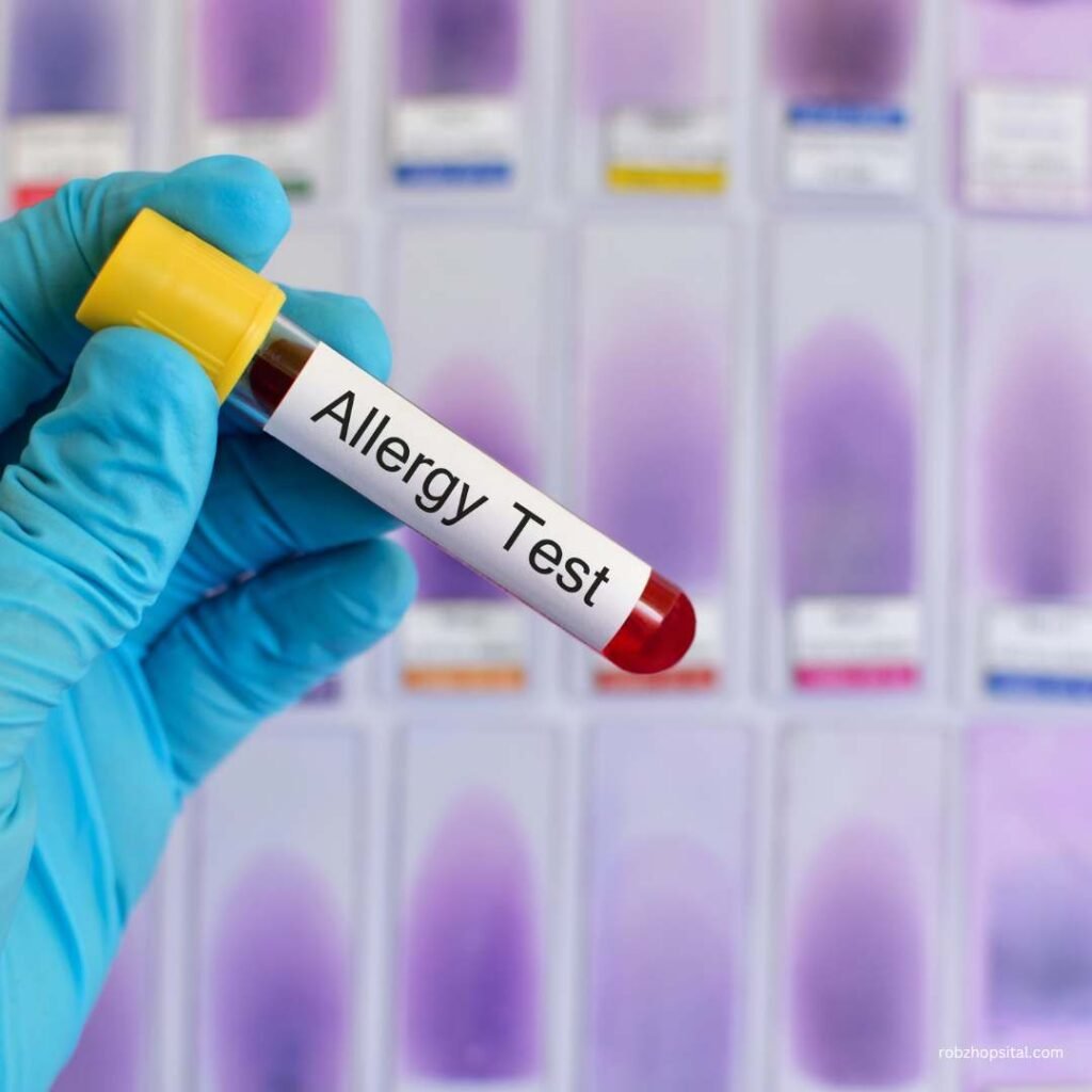 allergy test noida